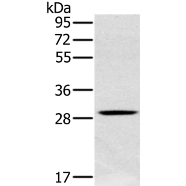 CLIC1 Antibody from Signalway Antibody (36633) - Antibodies.com