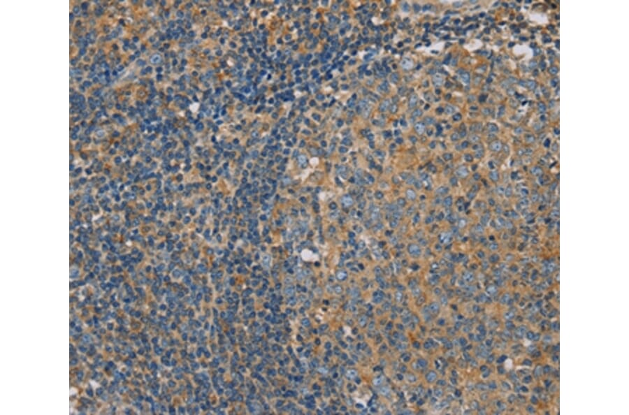 Immunohistochemistry - CLIC1 Antibody from Signalway Antibody (36633) - Antibodies.com
