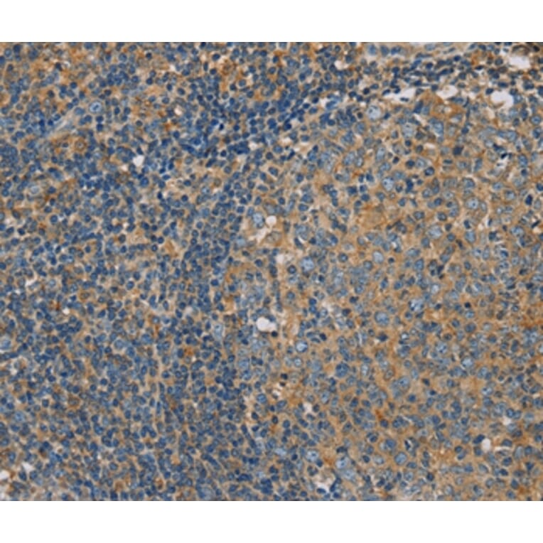 Immunohistochemistry - CLIC1 Antibody from Signalway Antibody (36633) - Antibodies.com