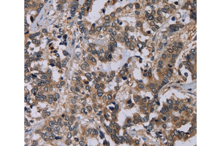 Immunohistochemistry - PVRL4 Antibody from Signalway Antibody (36647) - Antibodies.com