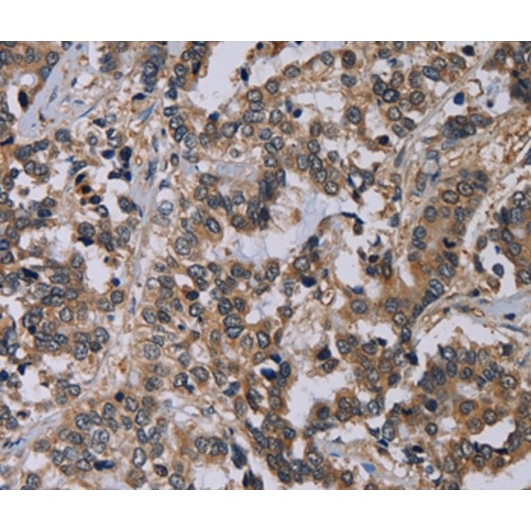 Immunohistochemistry - PVRL4 Antibody from Signalway Antibody (36647) - Antibodies.com