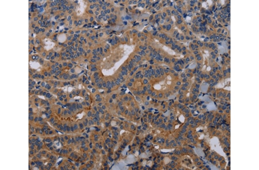 Immunohistochemistry - PVRL3 Antibody from Signalway Antibody (36648) - Antibodies.com