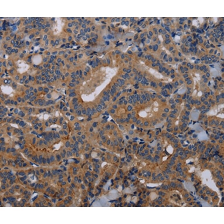 Immunohistochemistry - PVRL3 Antibody from Signalway Antibody (36648) - Antibodies.com