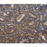 Immunohistochemistry - PVRL3 Antibody from Signalway Antibody (36648) - Antibodies.com