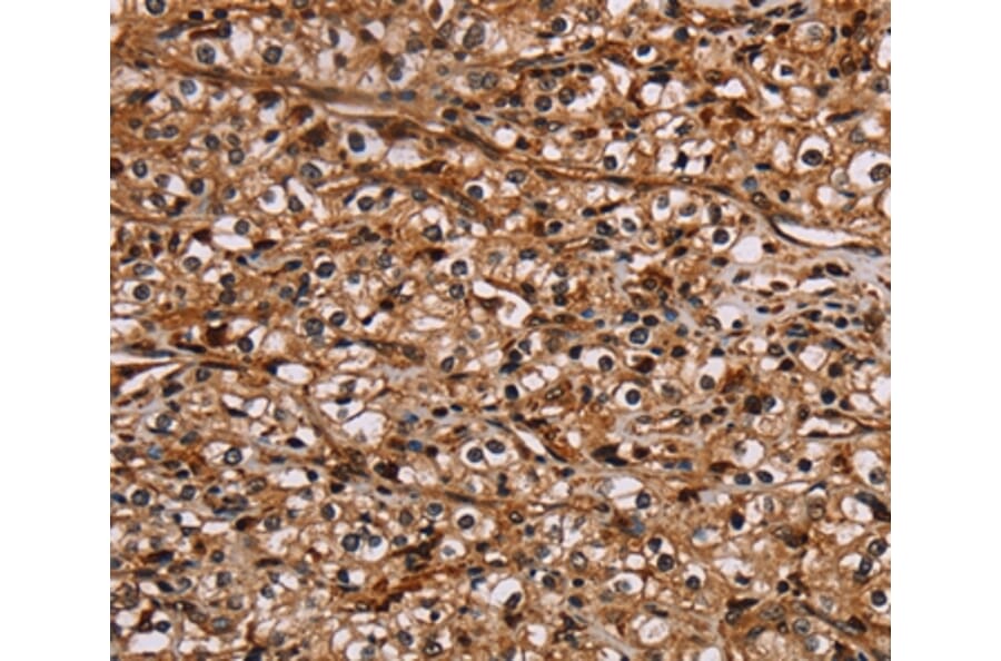 Immunohistochemistry - NOC2L Antibody from Signalway Antibody (36655) - Antibodies.com