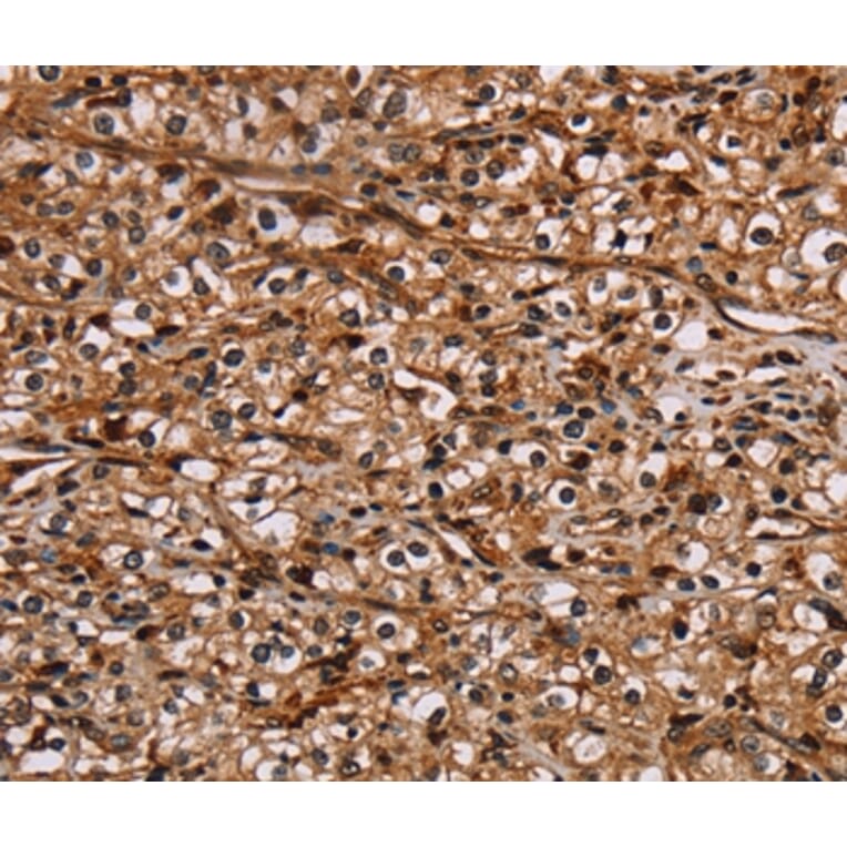 Immunohistochemistry - NOC2L Antibody from Signalway Antibody (36655) - Antibodies.com