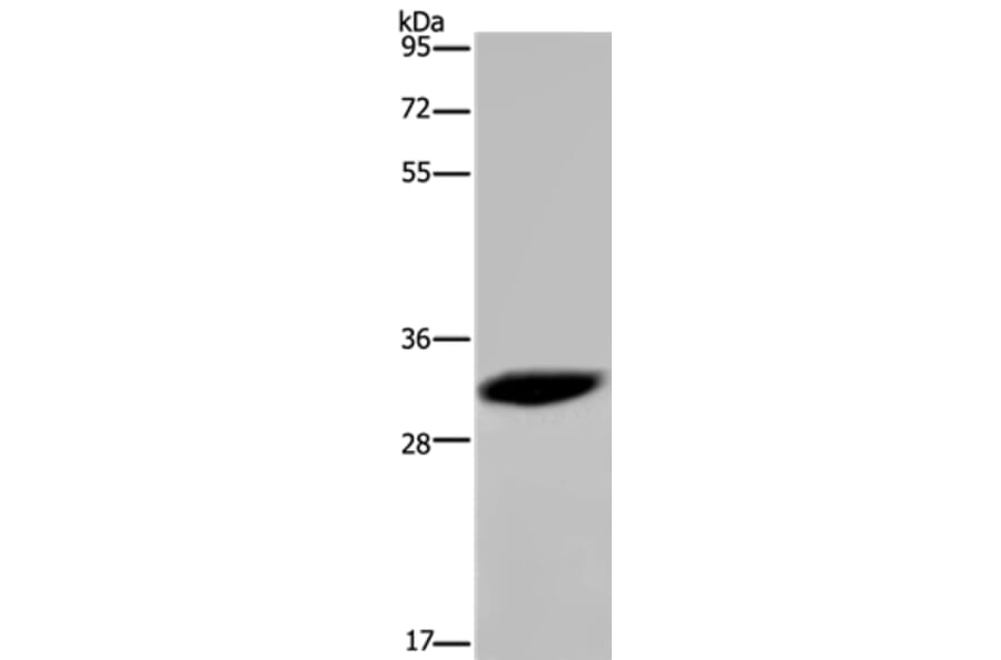 HMGN5 Antibody from Signalway Antibody (36661) - Antibodies.com