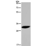 HMGN5 Antibody from Signalway Antibody (36661) - Antibodies.com