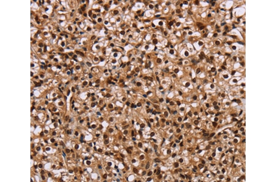 Immunohistochemistry - HMGN5 Antibody from Signalway Antibody (36661) - Antibodies.com