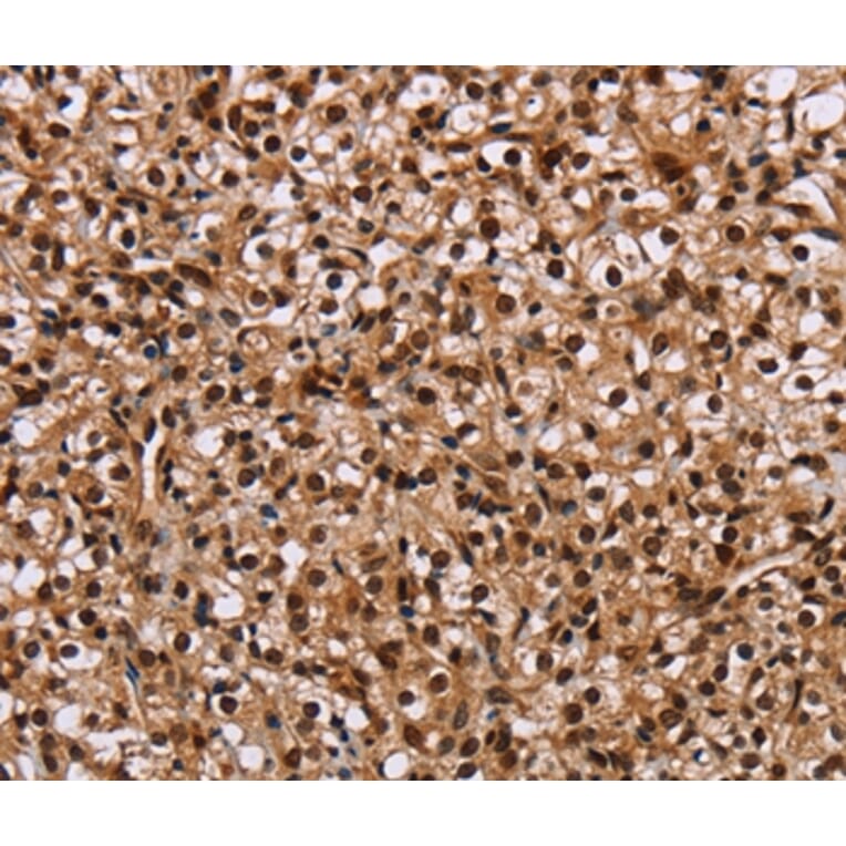 Immunohistochemistry - HMGN5 Antibody from Signalway Antibody (36661) - Antibodies.com