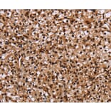 Immunohistochemistry - HMGN5 Antibody from Signalway Antibody (36661) - Antibodies.com