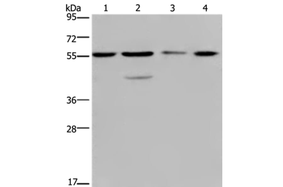 NUP50 Antibody from Signalway Antibody (36664) - Antibodies.com