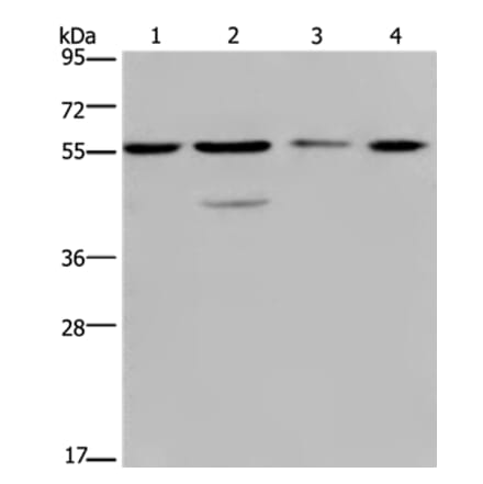 NUP50 Antibody from Signalway Antibody (36664) - Antibodies.com