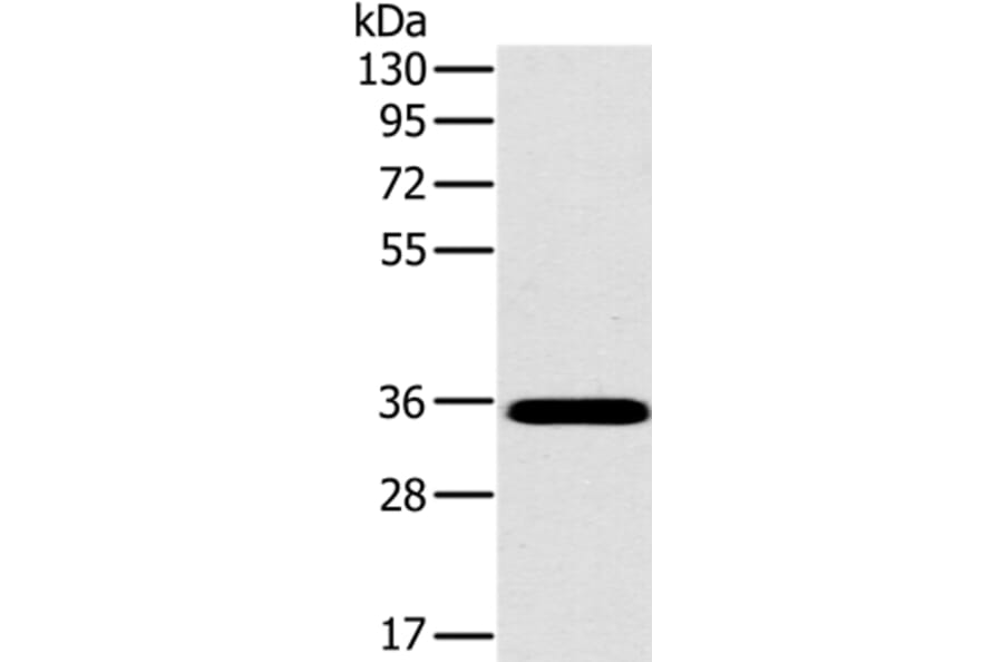 OTUB1 Antibody from Signalway Antibody (36672) - Antibodies.com