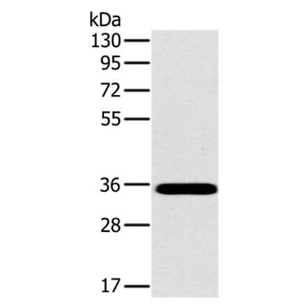 OTUB1 Antibody from Signalway Antibody (36672) - Antibodies.com