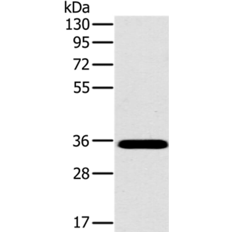 OTUB1 Antibody from Signalway Antibody (36672) - Antibodies.com