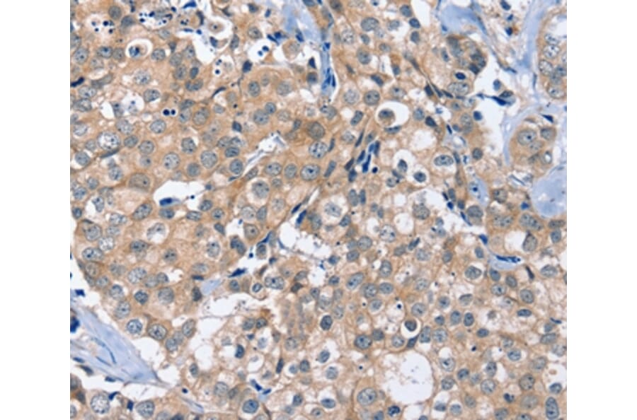 Immunohistochemistry - OTUB1 Antibody from Signalway Antibody (36672) - Antibodies.com
