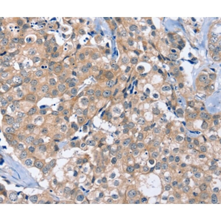 Immunohistochemistry - OTUB1 Antibody from Signalway Antibody (36672) - Antibodies.com