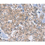 Immunohistochemistry - OTUB1 Antibody from Signalway Antibody (36672) - Antibodies.com