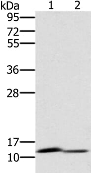 Gel: 10% SDS-PAGE Lysates (from left to right): Mouse brain and kidney tissue Amount of lysate: 40ug per lane Primary antibody: 1/400 dilution Secondary antibody dilution: 1/8000 Exposure time: 1 minute