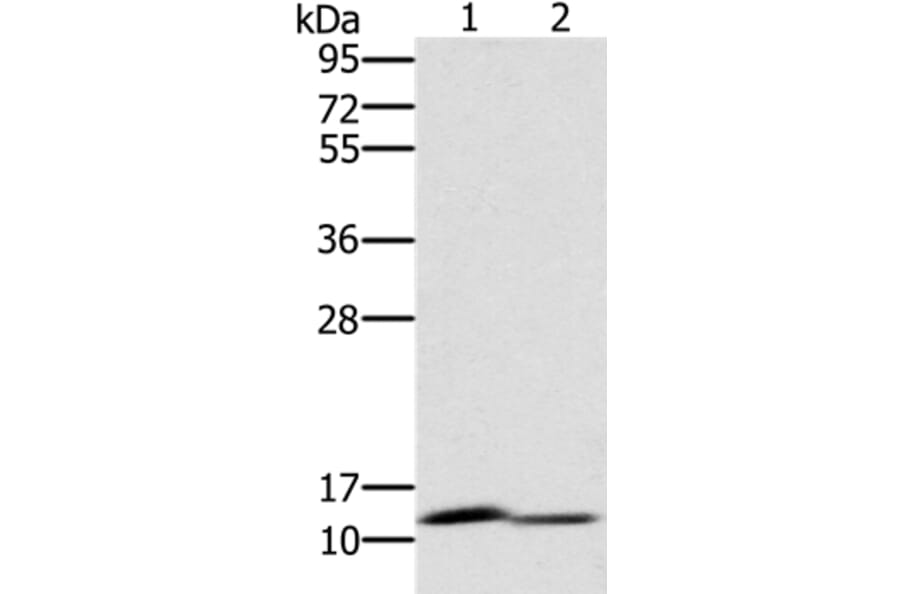 PAGE2 Antibody from Signalway Antibody (36678) - Antibodies.com