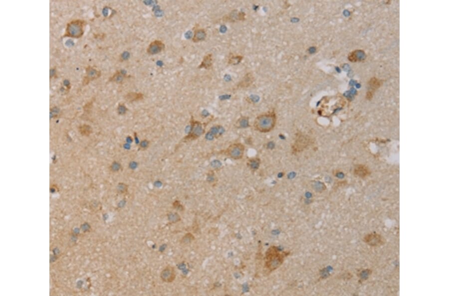 Immunohistochemistry - PAGE2 Antibody from Signalway Antibody (36678) - Antibodies.com