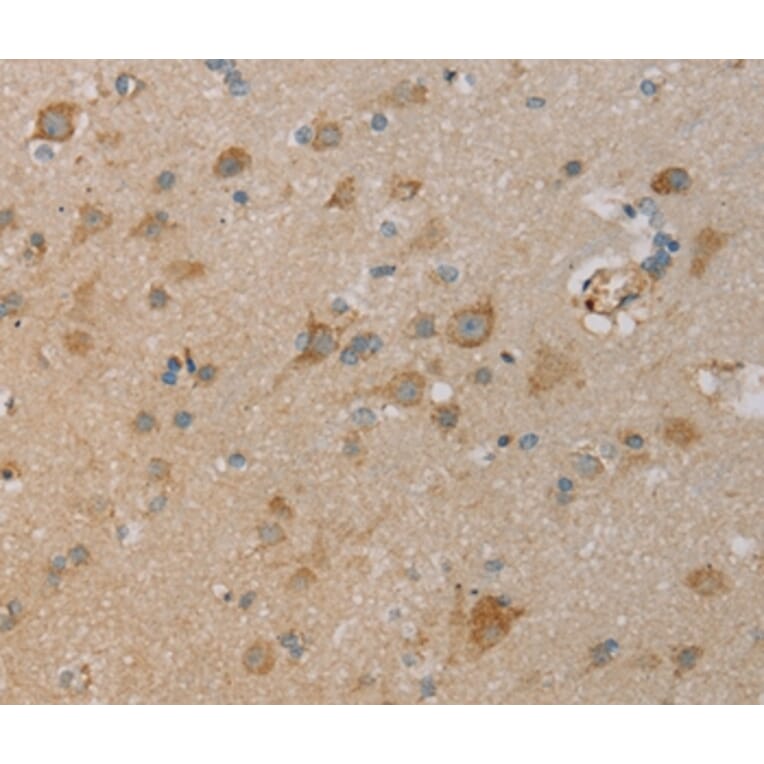 Immunohistochemistry - PAGE2 Antibody from Signalway Antibody (36678) - Antibodies.com