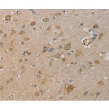 Immunohistochemistry - PAGE2 Antibody from Signalway Antibody (36678) - Antibodies.com