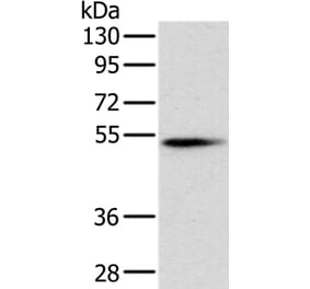 PNLIP Antibody from Signalway Antibody (36681) - Antibodies.com