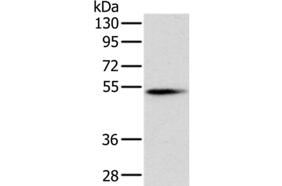 PNLIP Antibody from Signalway Antibody (36681) - Antibodies.com