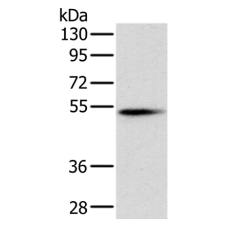 PNLIP Antibody from Signalway Antibody (36681) - Antibodies.com