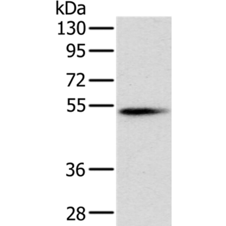 PNLIP Antibody from Signalway Antibody (36681) - Antibodies.com