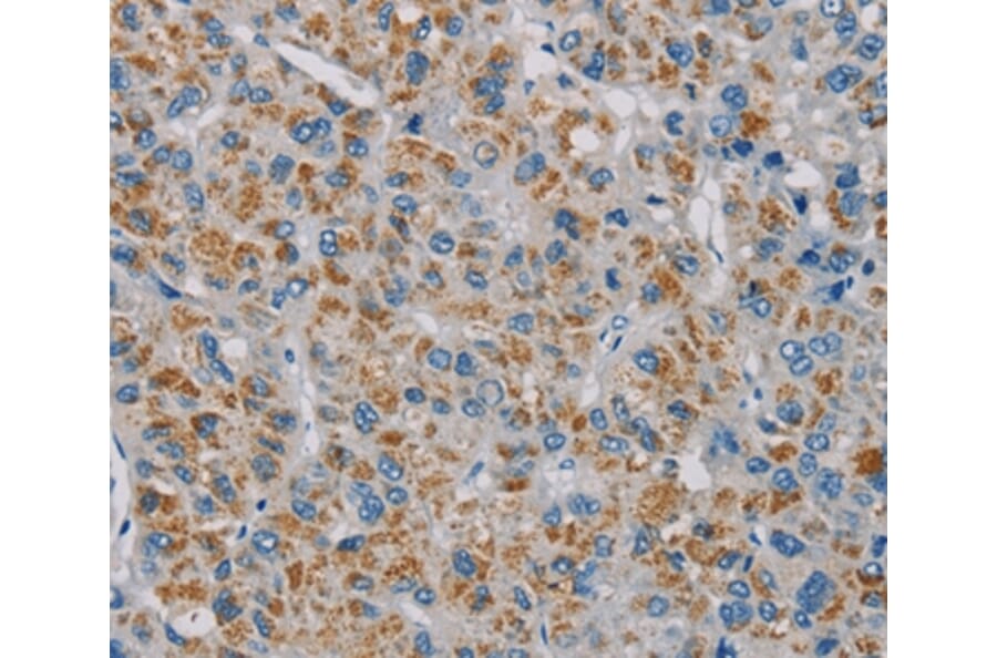 Immunohistochemistry - PNLIP Antibody from Signalway Antibody (36681) - Antibodies.com