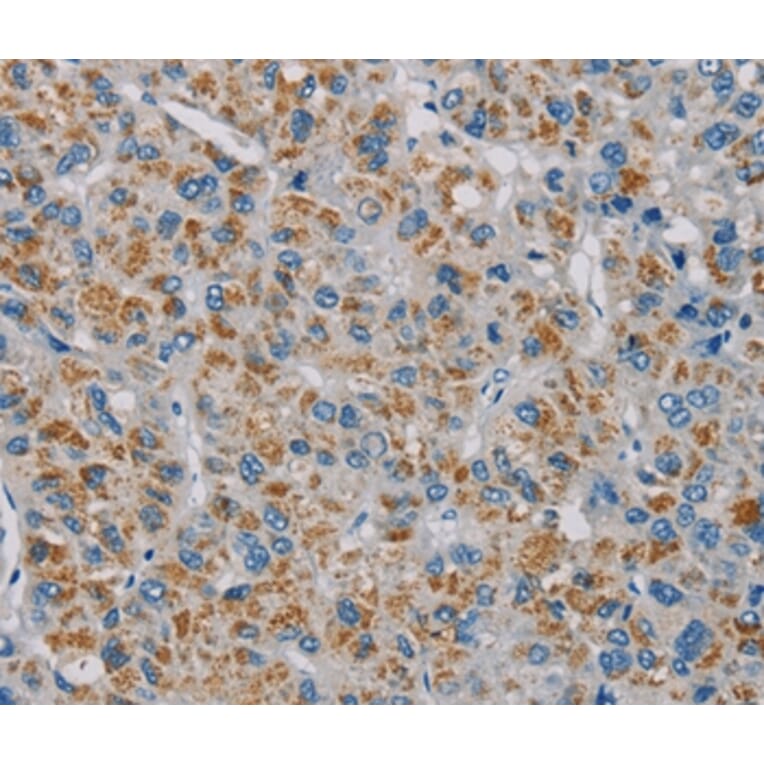 Immunohistochemistry - PNLIP Antibody from Signalway Antibody (36681) - Antibodies.com