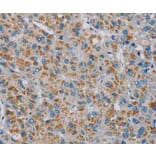 Immunohistochemistry - PNLIP Antibody from Signalway Antibody (36681) - Antibodies.com