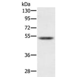 PMPCB Antibody from Signalway Antibody (36698) - Antibodies.com