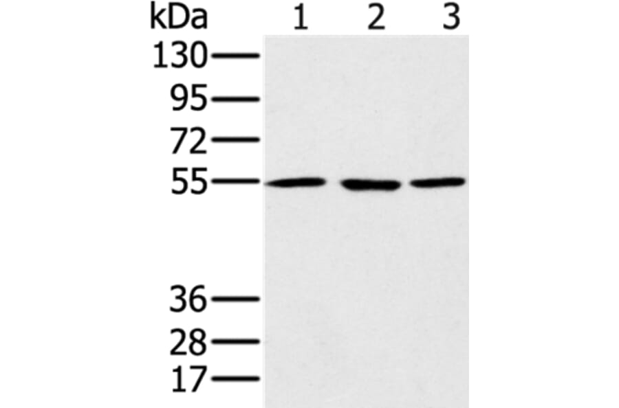 PSMC1 Antibody from Signalway Antibody (36704) - Antibodies.com