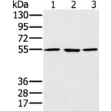 PSMC1 Antibody from Signalway Antibody (36704) - Antibodies.com