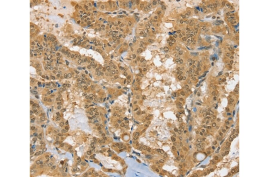 Immunohistochemistry - PSMC1 Antibody from Signalway Antibody (36704) - Antibodies.com