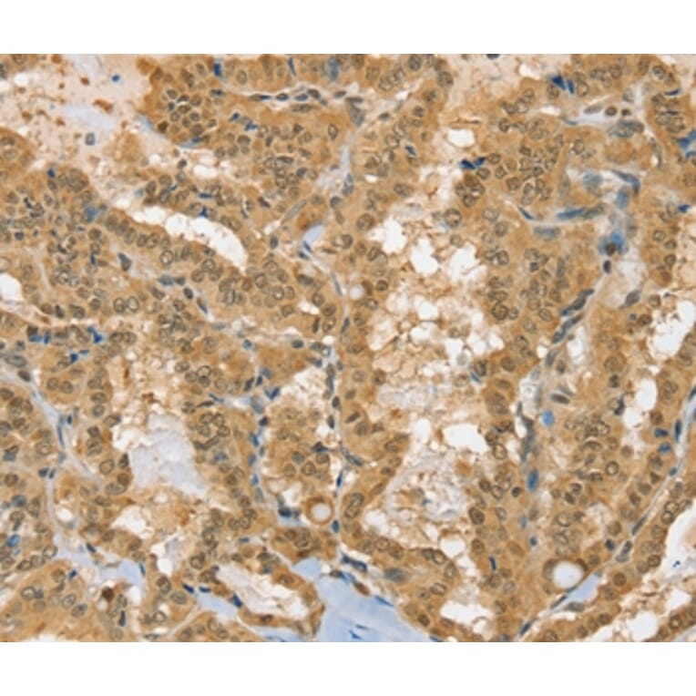 Immunohistochemistry - PSMC1 Antibody from Signalway Antibody (36704) - Antibodies.com