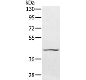 PTPN7 Antibody from Signalway Antibody (36706) - Antibodies.com