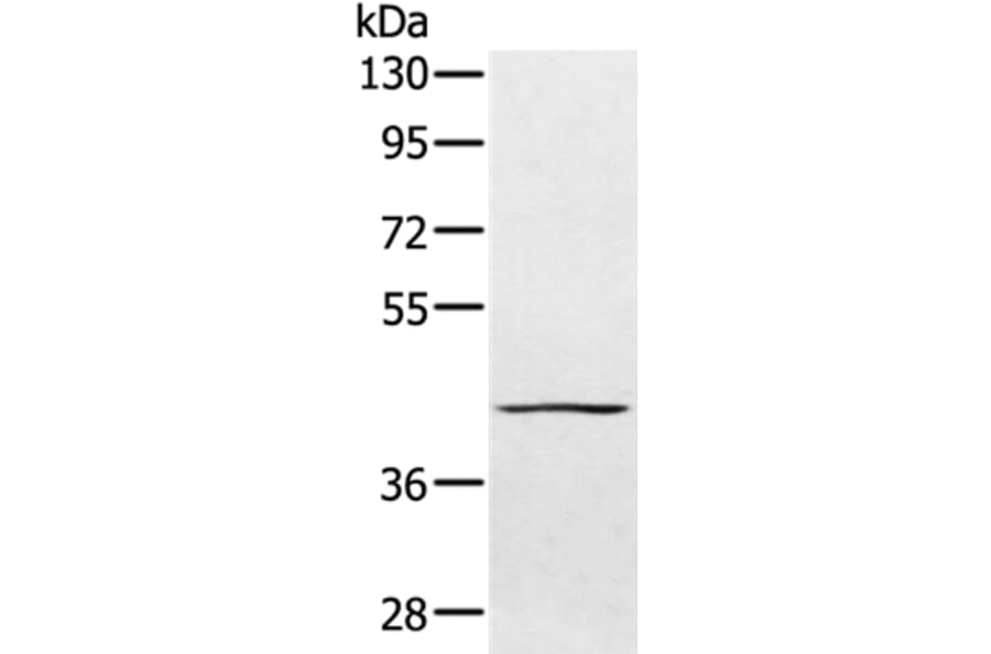 PTPN7 Antibody from Signalway Antibody (36706) - Antibodies.com