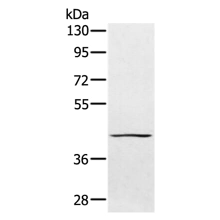 PTPN7 Antibody from Signalway Antibody (36706) - Antibodies.com