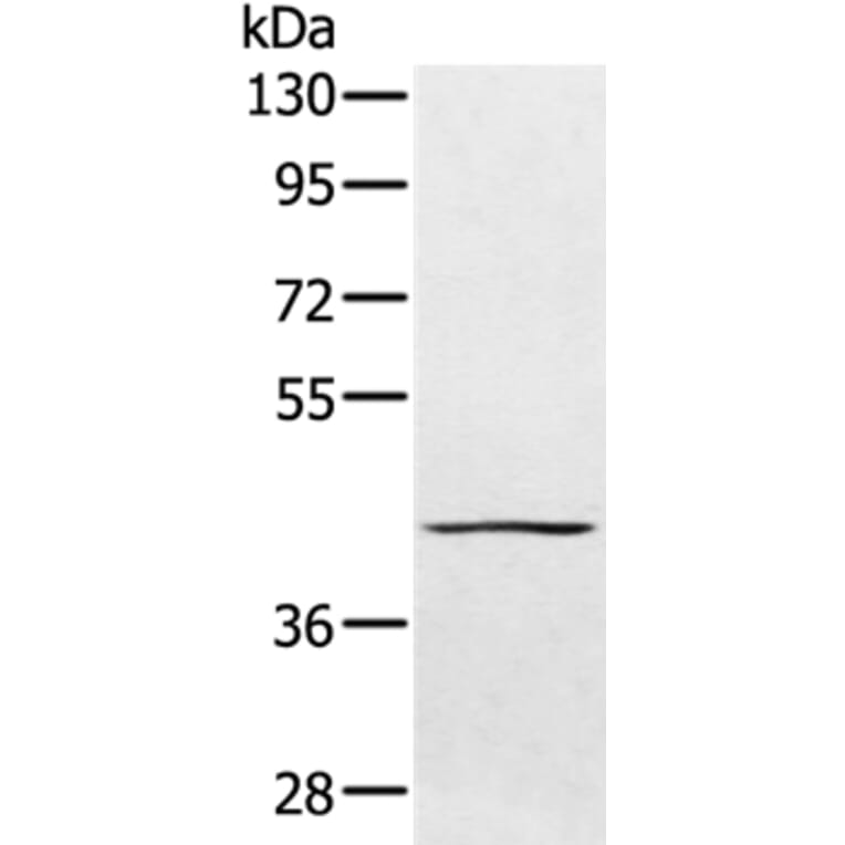 PTPN7 Antibody from Signalway Antibody (36706) - Antibodies.com