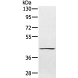 PTPN7 Antibody from Signalway Antibody (36706) - Antibodies.com