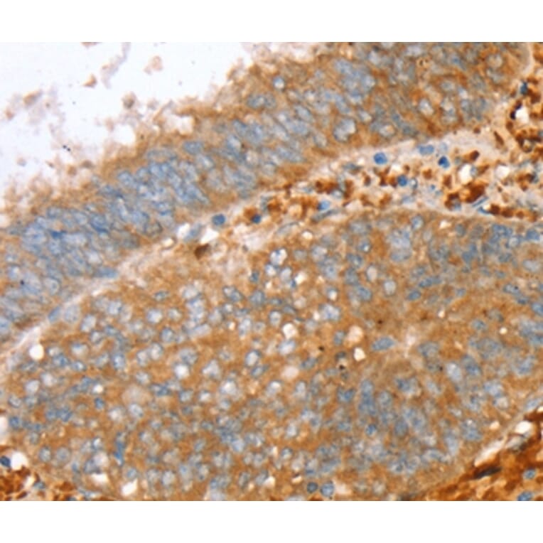 Immunohistochemistry - PTPN7 Antibody from Signalway Antibody (36706) - Antibodies.com
