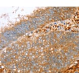 Immunohistochemistry - PTPN7 Antibody from Signalway Antibody (36706) - Antibodies.com