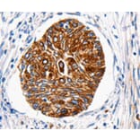 Immunohistochemistry - HTR1A Antibody from Signalway Antibody (36720) - Antibodies.com