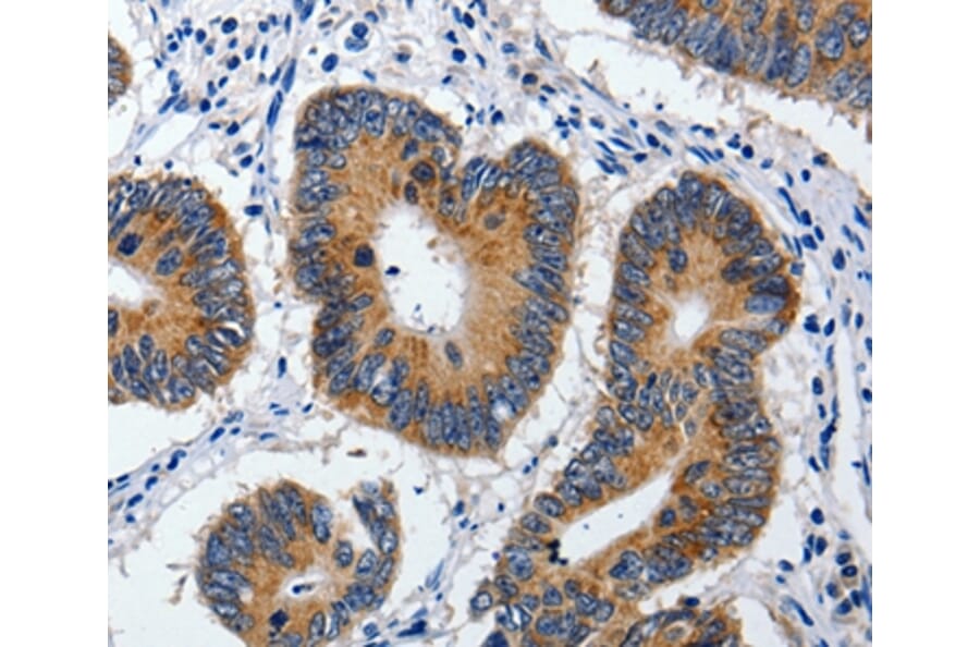 Immunohistochemistry - ABCB9 Antibody from Signalway Antibody (36722) - Antibodies.com