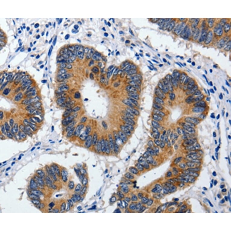 Immunohistochemistry - ABCB9 Antibody from Signalway Antibody (36722) - Antibodies.com
